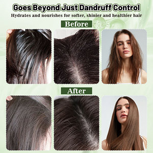 OEM/ODM Hair Silking Mist Cleansing Kopfhaut öl-Kontrolle Entfernen Sie Geruch Minze Anti Itchy Relief Kopfhaut Haar erfrischung <span class=keywords><strong>spray</strong></span> - Product Image 3