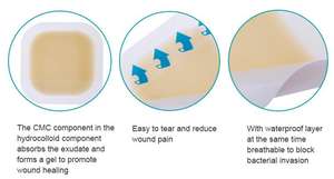 La blessure stérile médicale jetable Offre Spéciale raccorde le habillage hydrocolloïde pour le soin exsudant de blessure - Product Image 5
