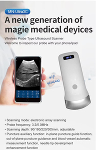 Ultra Scanner de poche sans fil Sonde à réseau linéaire convexe <span class=keywords><strong>portable</strong></span> Obstétrique Abdomen Couleur Doppler Usage vétérinaire - Product Image 4