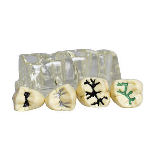 Modelo de Sellador de Fisuras Dentales Transparente para Niños, para la Prevención de Caries, Procedimiento de Obturación Dental, Accesorio de Equipo de Terapia Oral - Product Image 2