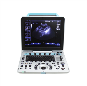 Sistema Diagnostico Veterinario a Ultrasuoni Doppler da 15 Pollici per <span class=keywords><strong>Esame</strong></span> Ostetrico di Bovini, Cavalli, Suini, Ovini, Cani e Gatti - Product Image 5