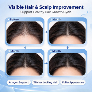 Máquina Láser Portátil para el Crecimiento del Cabello con Juego Completo de Accesorios, Detector de Cuero Cabelludo, Pistola Rociadora, Cepillo de Fotones y Peine Eléctrico - Product Image 2