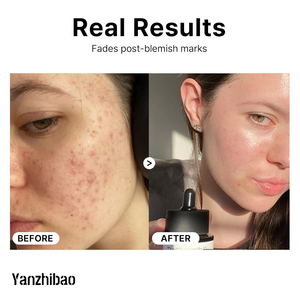 OEM 나이아신아마이드 15% 페이스 세럼 비타민 미백 0.67 Fl.oz 모공 축소 및 붉은기 완화 - Product Image 4