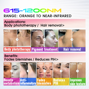Máquina Antienvejecimiento BBL <span class=keywords><strong>Plus</strong></span> de Nivel Médico, Dispositivo Reafirmante Antiarrugas para Cuello, Rostro y Cuerpo Completo - Product Image 3
