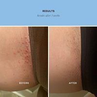 Crème Exfoliante Bio Personnalisée Réduit l'Apparence des Poils Incarnés et des Bosses sous les Aisselles Apaise la Peau Post-Rasage et Atténue les Rougeurs