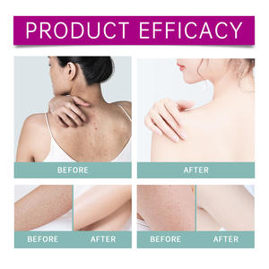 Gommage au beurre de karité pour les voyages Renouvellement hydratant quotidien de la peau avec gommage antioxydant pour le corps - Product Image 6