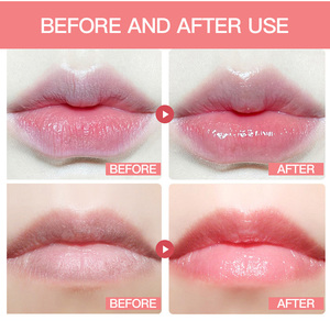 Balsamo Labbra Naturale Biologico Vegano RTS 10g Stick Crema Impermeabile Protezione Solare Lucidalabbra Gel Rossetto Trucco Tinta Cura Labbra al Miele - Product Image 4