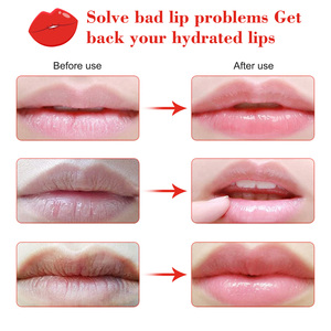 Mascarilla Labial Vegana Coreana al por Mayor, Mascarilla Reparadora de <span class=keywords><strong>Labios</strong></span> con Colágeno Intensamente Hidratante <span class=keywords><strong>para</strong></span> el Cuidado de los <span class=keywords><strong>Labios</strong></span> - Product Image 5