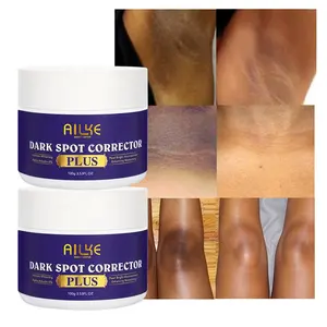 Ailke Skincare Beauty Whitening Face Neck Hand And Foot Organic Removal Dark Spot Remover Cream Face Directly Whitening Cream