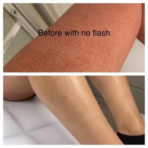 Crème Blanchissante 7 Jours Jambes Fraise Atténue les Taches Peau Lisse Exfoliante - Product Image 5