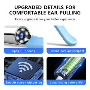 <b>Ear</b> <b>Wax</b> <b>Removal</b> Tool Smart <b>Ear</b> Cleaner Camera Scope with Light Smartphone <b>Ear</b> HD Video Otoscope <b>Wax</b> Cleaner for Android PC - Product Image 3
