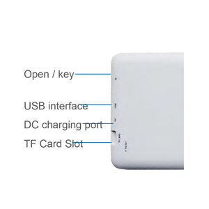 पोर्टेबल स्त्री रोग संबंधी मिनी हैंडहेल्ड इलेक्ट्रॉनिक कोपोस्कोप डिजिटल वीडियो कोपोस्कोप - Product Image 5