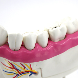 Modèles anatomiques de l'arcade dentaire et des molaires Qinghua : Instruments pédagogiques de biologie pour les collèges et lycées et modèles médicaux - Product Image 2
