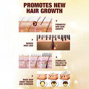 <span class=keywords><strong>Aceite</strong></span> <span class=keywords><strong>para</strong></span> <span class=keywords><strong>el</strong></span> Crecimiento del <span class=keywords><strong>Cabello</strong></span> <span class=keywords><strong>de</strong></span> Venta al por Mayor, <span class=keywords><strong>Aceite</strong></span> Natural <span class=keywords><strong>de</strong></span> Crecimiento Rápido <span class=keywords><strong>para</strong></span> <span class=keywords><strong>el</strong></span> <span class=keywords><strong>Cabello</strong></span>, Marca Privada, <span class=keywords><strong>para</strong></span> Hombres y Mujeres, Suero Orgánico <span class=keywords><strong>para</strong></span> <span class=keywords><strong>el</strong></span> Recrecimiento del <span class=keywords><strong>Cabello</strong></span> - Product Image 4