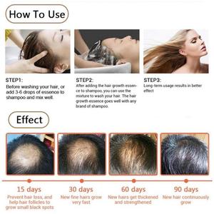 Siero all'ingrosso di crescita dei capelli dell'etichetta privata arricciato con olio di trattamento dei capelli di crescita di estensione dei capelli dell'estratto di zenzero Dropshipping - Product Image 4