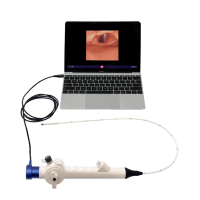Laryngoscope vidéo flexible USB Sensorendo, bronchoscope jetable, rhinolaryngoscope ORL, kit d'intubation pour ordinateur portable, téléphone, tablette