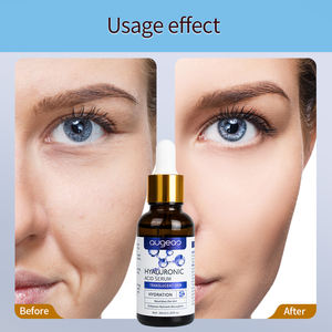 Kaliteli C Vitamini Yüz Hyaluronik Asit Yaşlanma Karşıtı Beyazlatıcı Cilt Bakımı Yüz Serumu - Product Image 2