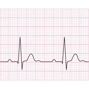 Varmt salg i 50*20 55*44 210*300-200P 150*100-150P 신 pris medicinsk EKG termisk papirrullle ultralysk termisk papirrullle