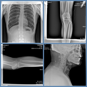 Großhandel für zahn ärztliche Geräte Digitales hand gehaltenes zahn ärztliches Röntgengerät mit Touchscreen für medizinische veterinär medizinische Zwecke Dog Animal Imaging - Product Image 5