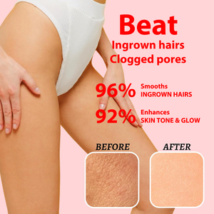 <span class=keywords><strong>Gommage</strong></span> corporel éclaircissant et blanchissant à l'acide kojique, vitamine C, AHA et BHA pour les aisselles, l'intérieur des cuisses, la zone <span class=keywords><strong>intime</strong></span> et le maillot de bain - Product Image 4