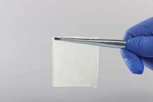 LUOFUCON Perban Kolagen Medis untuk Luka Kronis - Perawatan Ulser Diabetes, Luka Tekan & Ulser Kaki Vena - Product Image 4