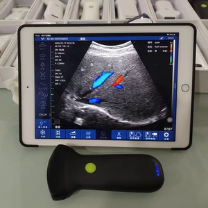 Sonde d'échographie médicale portable sans fil DMU81, scanner d'échographie abdominale convexe, Wifi USG, sonde d'échographie 192 éléments - Product Image 4