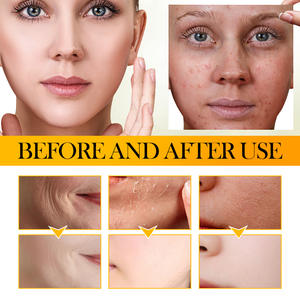 OEM SADOER Label pribadi perawatan kulit, Gairah buah <span class=keywords><strong>Vitamin</strong></span> B2 esensi antioksidan pemutih pelembab perbaikan <span class=keywords><strong>vitamin</strong></span> <span class=keywords><strong>c</strong></span> - Product Image 6