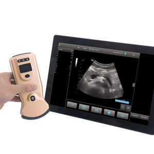 Draadloze Kleur <span class=keywords><strong>Doppler</strong></span> Echografie Sonde Handheld Echografie Sonde 80 Array Elementen 32 Kanalen - Product Image 3