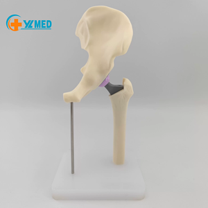 Modello di Sostituzione dell'Anca in Scala Ridotta per Comunicazione Clinica tra Ortopedisti e Pazienti - Product Image 1