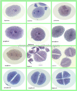Juego de Portaobjetos de <span class=keywords><strong>Microscopio</strong></span> para Ciencias Médicas, Muestra de <span class=keywords><strong>Mitosis</strong></span> y Meiosis de Zea Mays, Material Educativo para la Enseñanza - Product Image 4