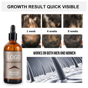 Huile <span class=keywords><strong>de</strong></span> croissance capillaire biologique pour hommes et femmes, meilleure marque <span class=keywords><strong>de</strong></span> distributeur OEM, sérum <span class=keywords><strong>anti</strong></span>-<span class=keywords><strong>chute</strong></span> <span class=keywords><strong>de</strong></span> <span class=keywords><strong>cheveux</strong></span> avec romarin biotine - Product Image 5
