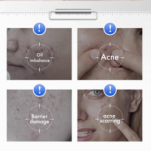 Venta caliente Perfecting 2% BHA + Vitaminas de ácido láctico Suero de ácido salicílico de textura no pegajosa estabilizante calmante e hidratante - Product Image 4