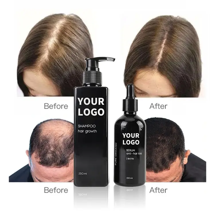 Atacado Profissional Biotina Queratina shampoo Anti perda de cabelo shampoo e condicionador com private label
