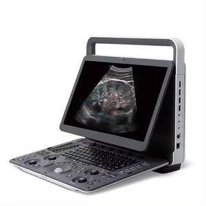 Máquina de ultrasonido veterinario <span class=keywords><strong>Sonoscape</strong></span> e1v para veterinario color doppler animal máquina de ultrasonido portátil - Product Image 3
