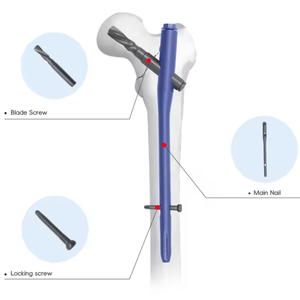 Clavo Intramedular de Bloqueo para Traumatismos de Fémur, Tibia y Húmero - Product Image 2