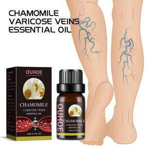 OUHOE Vente en gros OEM Soin de la peau Réparation des <span class=keywords><strong>varices</strong></span> Sérum <span class=keywords><strong>pour</strong></span> éliminer les <span class=keywords><strong>varices</strong></span> Traitement des <span class=keywords><strong>varices</strong></span> <span class=keywords><strong>Huile</strong></span> <span class=keywords><strong>essentielle</strong></span> de camomille 10 ml - Product Image 3