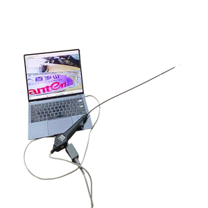 Ureteroscopio Flexible con Video, Endoscopio Eléctrico de Diagnóstico Urológico, Uroscopio HY-YMN2.8 - Product Image 3