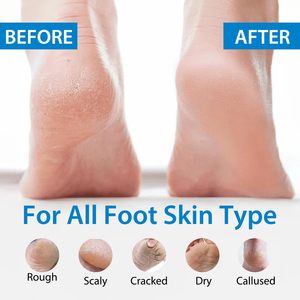 Crema per la cura del piede per i tacchi screpolati esfoliante Anti Crack Peeling pelle morta per la riparazione del piede sbiancante Urea crema per i piedi - Product Image 2