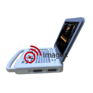 Machine combinée innovante 2-en-1 à ultrasons Doppler couleur et ECG EKG pour un diagnostic cardiaque complet - Product Image 4