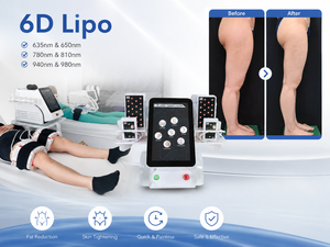 Láser Lipolítico 6D de Larga Duración Sin Cirugía / Lipoláser Montería / Lipoláser 6D / Resultados Láser para Adelgazamiento Corporal - Product Image 1