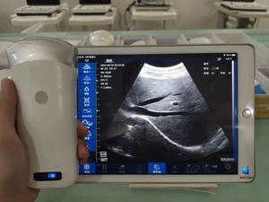 BESTRAN für Schweine Tragbarer Medizinischer Kabelloser Ultraschall-Konvexsonde mit Eingebauter Batterie aus Kunststoff 1 Jahr Garantie BT-UD82 - Product Image 2