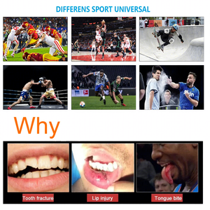 Protector Bucal Nuevo con Estuche de Almacenamiento, Protector Bucal Deportivo de EVA Anti-Rechinamiento, para Detener el Bruxismo y el Rechinamiento de Dientes por la Noche - Product Image 3