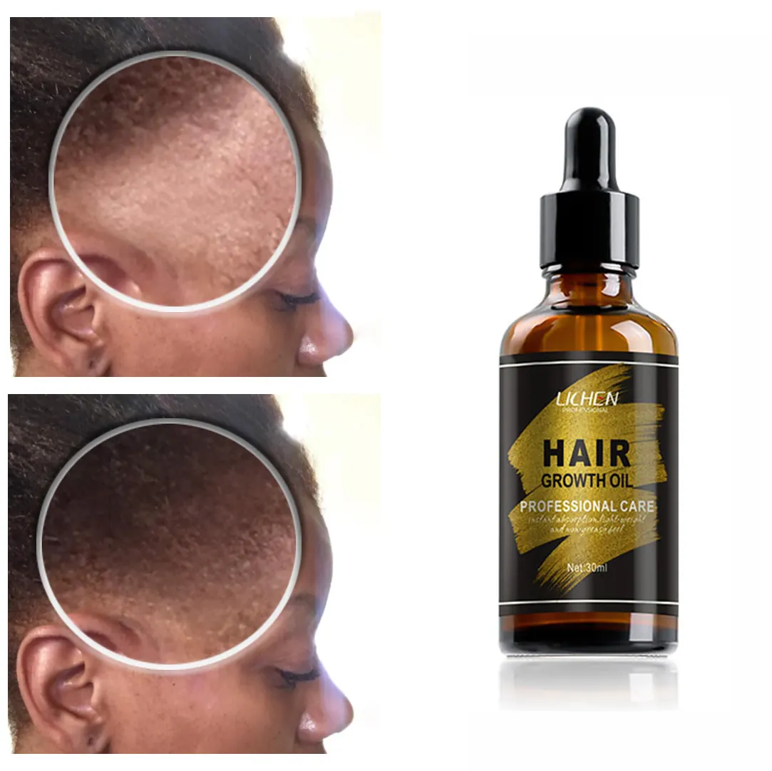 黒人女性のためのプライベートラベルヘアリペアオイルセラムヘアケア製品