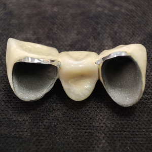 Tecnologia di stampa Laser 3D per cliniche dentali personalizzate corone e ponti in Cina laboratorio dentale - Product Image 6