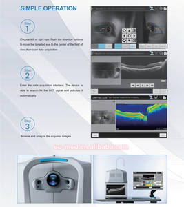 Máquina OCT Oftálmica Ó<span class=keywords><strong>ptica</strong></span> Totalmente Automática Más Económica, Tomografía de Coherencia Ó<span class=keywords><strong>ptica</strong></span> OCT-50 - Product Image 5