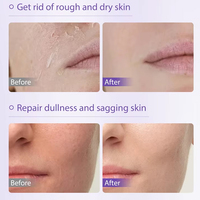Masque en poudre de gelée Vshell, vitamine C, anti-rides, anti-âge, hydratant, éclaircissant, masque facial pour femme, tous types de peau