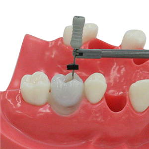 Simulatore Dentale per Pratica di Esame Odontoiatrico: Denti con Canale Radicolare e Cavità Pulpare Riempita in Resina - Product Image 6