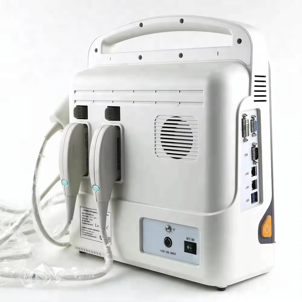 Color Doppler Ultrasound Color Doppler Ultrasound