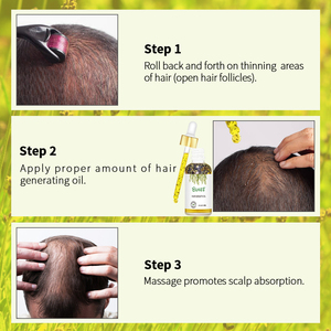 Aceite de botina de suero para el crecimiento del cabello de ricino antipérdida de cabello de etiqueta privada para mujeres negras - Product Image 3