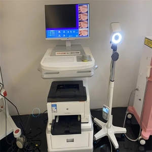 Colposcopio Digital HD de Fábrica, Colposcopio Digital al por Mayor - Product Image 4